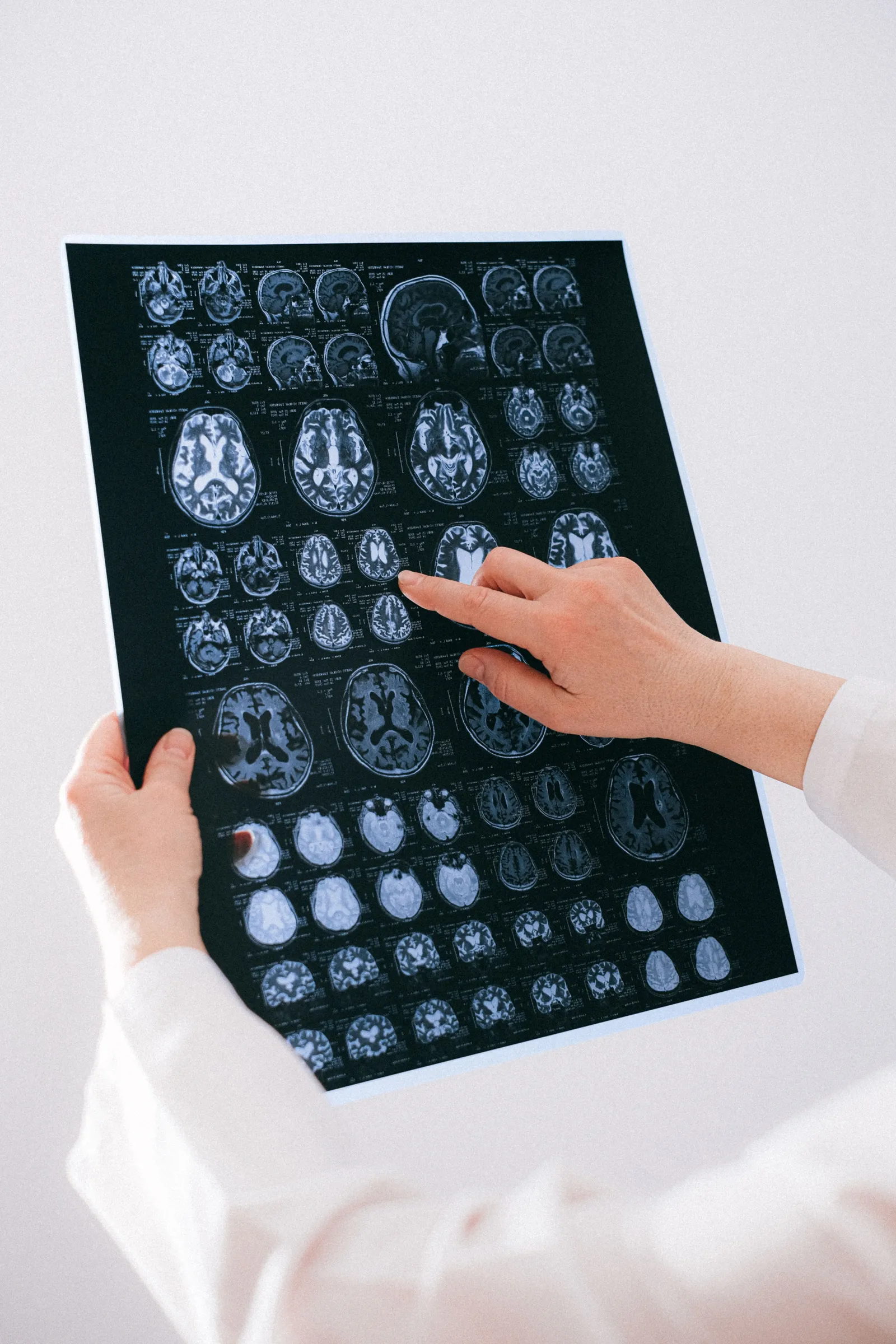 Neurology illustration