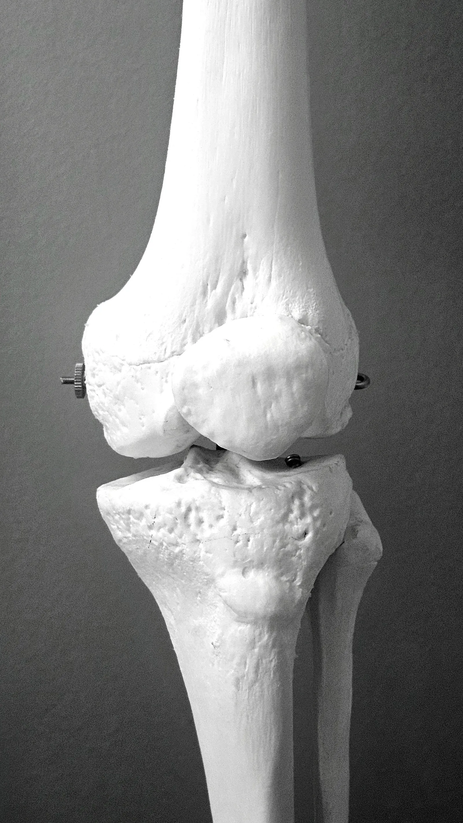 Orthopaedics illustration