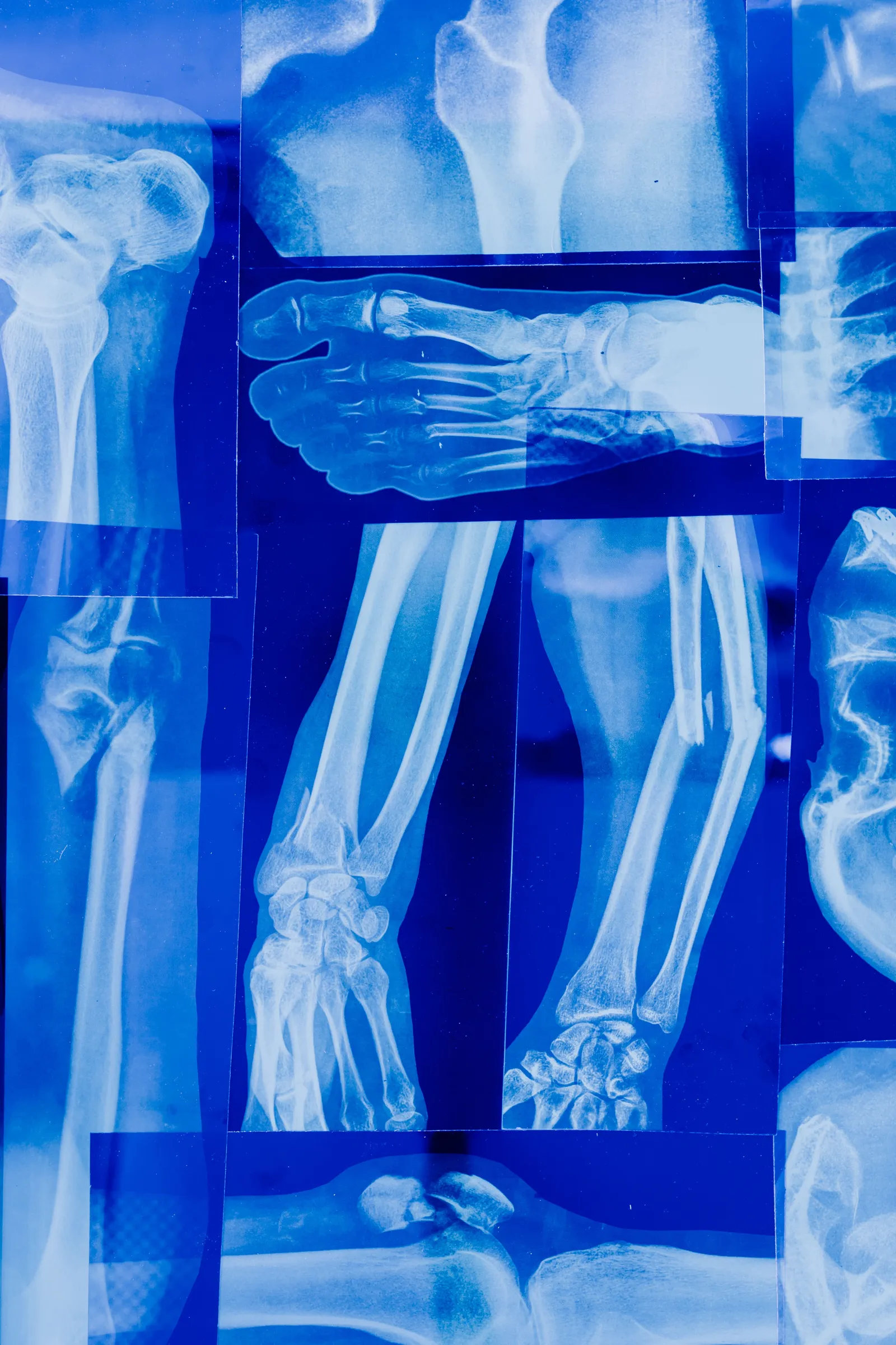 Rheumatology & Autoimmune Disorders illustration