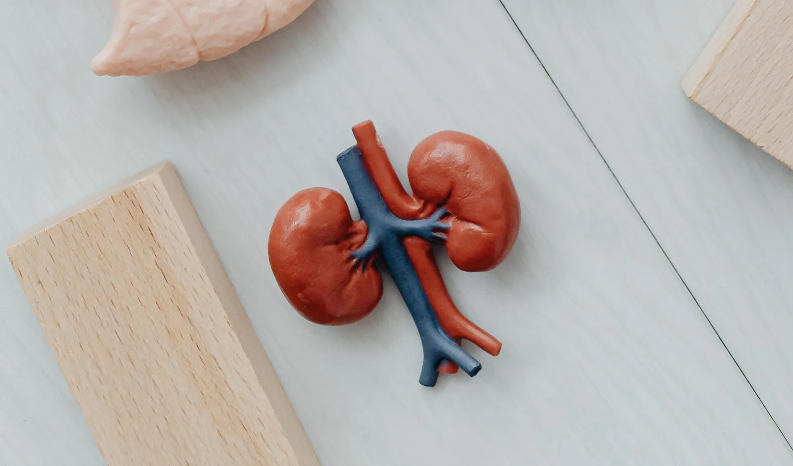 Urology illustration